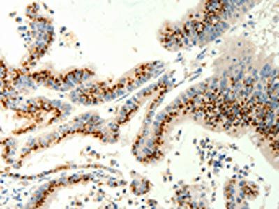 TRPC6 Antibody