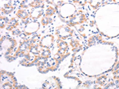 TRPC7 Antibody