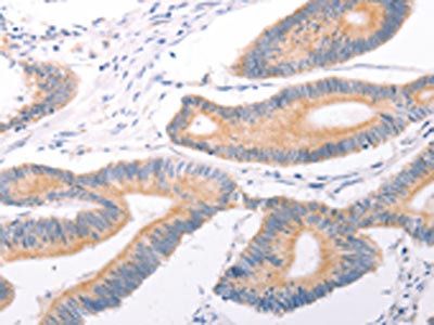 TRPC7 Antibody