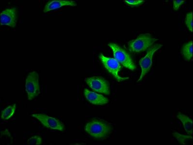 TRPM1 Antibody