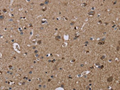TRPM1 Antibody
