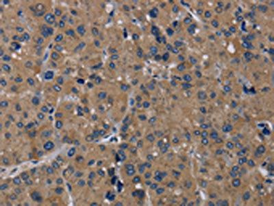 TRPM1 antibody