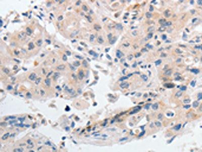TRPM1 Antibody
