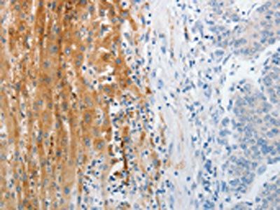 TRPM1 Antibody
