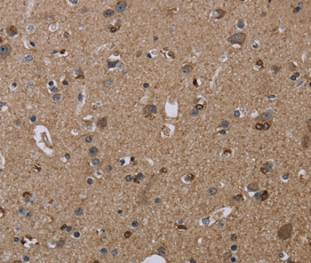 TRPM1 Antibody