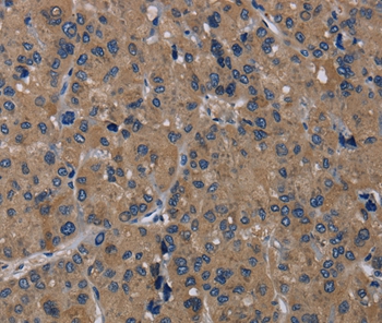 TRPM1 Antibody