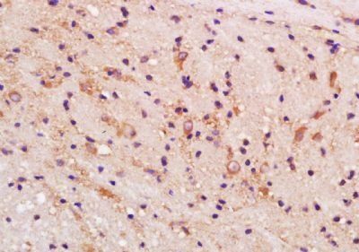 TRPM1 Rabbit Polyclonal Antibody