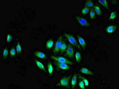 TRPM2 Antibody