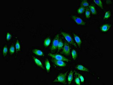 TRPM2 antibody