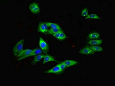 TRPM2 Antibody
