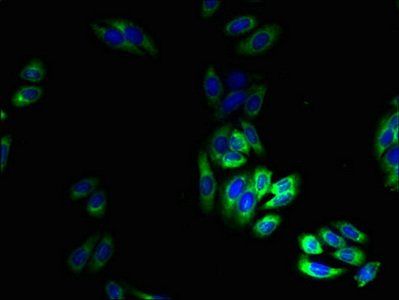 TRPM2 Antibody