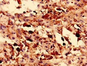 TRPM2 Antibody