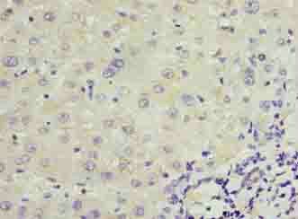 TRPM2 Antibody