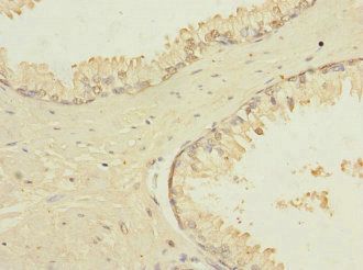 TRPM4 Antibody