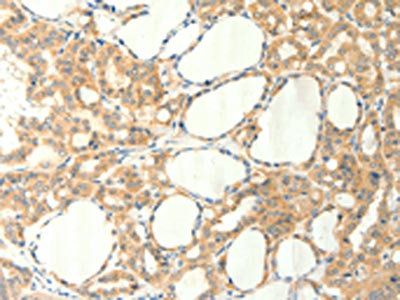 TRPM5 Antibody