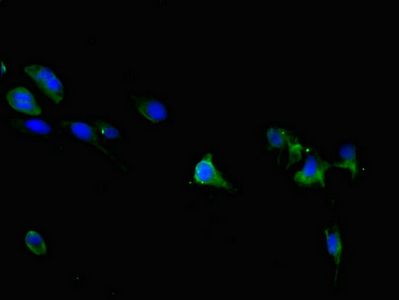 TRPM6 Antibody