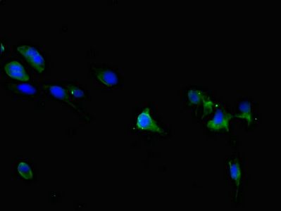 TRPM6 antibody