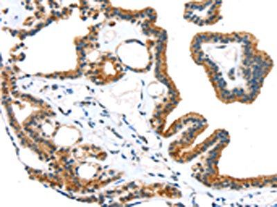 TRPM6 Antibody