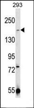 TRPM7 antibody