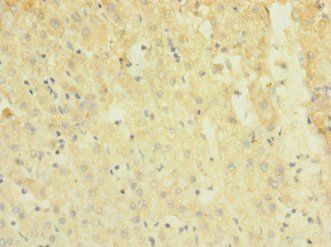 TRPM7 Antibody