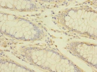 TRPM7 Antibody