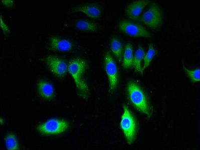 TRPM8 Antibody
