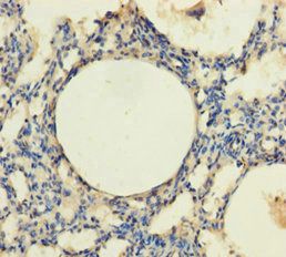 TRPM8 Antibody