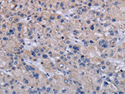 TRPM8 Antibody