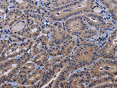 TRPM8 Antibody