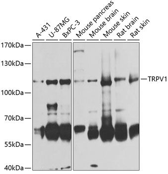 TRPV1 antibody