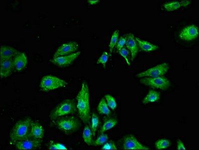 TRPV1 antibody