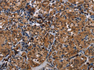 TRPV1 Antibody