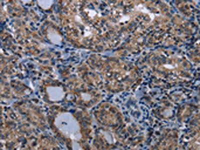 TRPV1 antibody