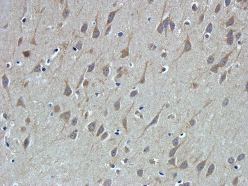 TRPV1 antibody