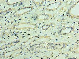 TRPV4 Antibody