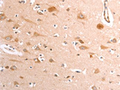 TRPV4 Antibody