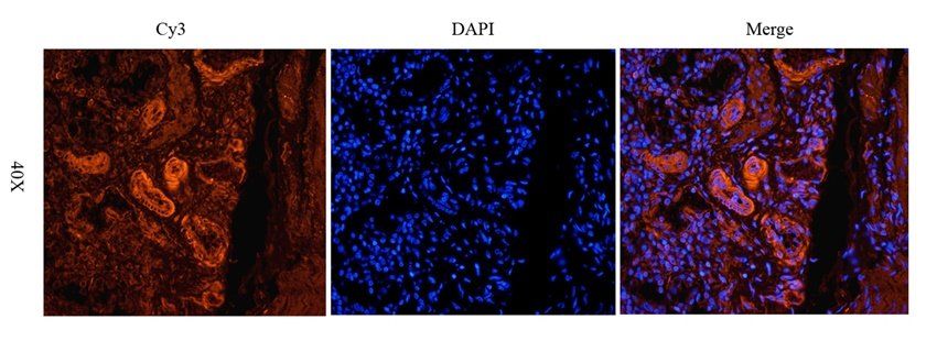 TRPV5 antibody