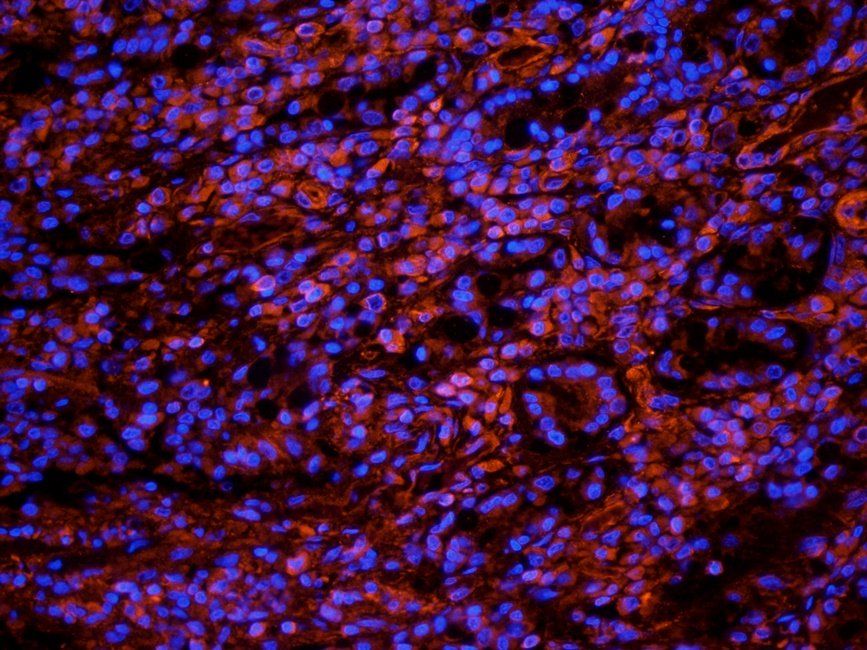 TRPV5 antibody