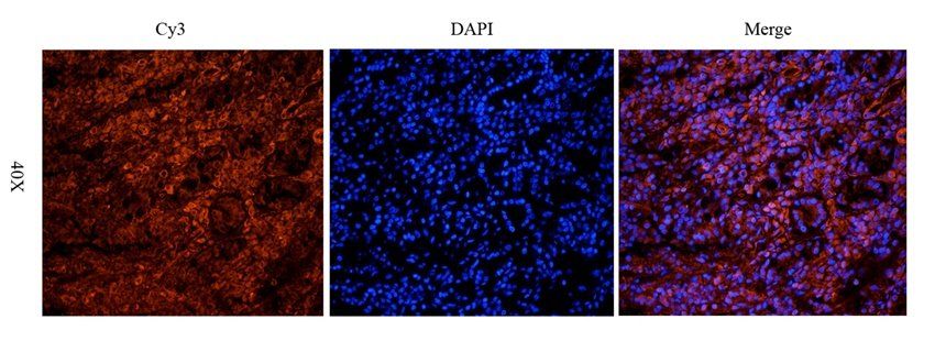 TRPV5 antibody