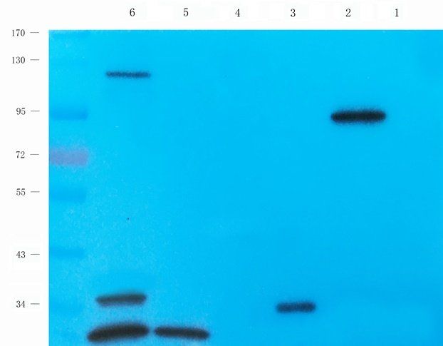 TRPV5 antibody