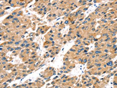 TRPV5 Antibody