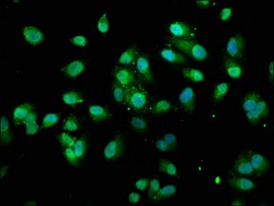 TRX antibody