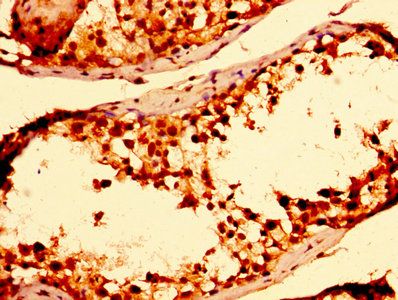 TXN Antibody