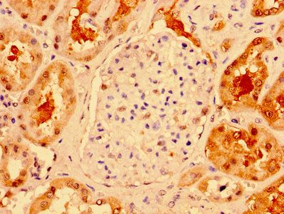 TXN Antibody