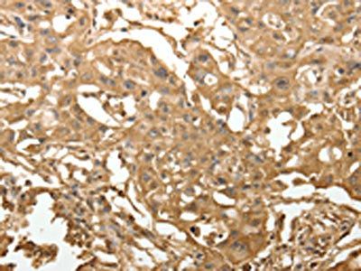 TXN Antibody