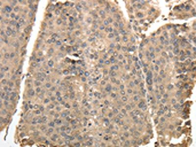 TXN Antibody