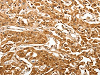 TXN Antibody
