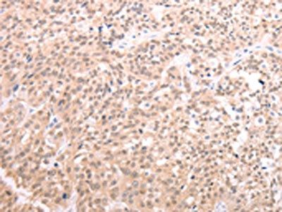 TXN Antibody