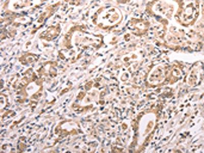 TXN Antibody