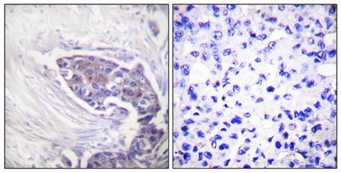 TRXR2 Antibody